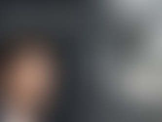 What is the Latest Technology in Hair Transplant 2026? FUEsion X Leading the Way