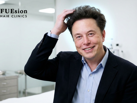 Did Elon Have a Hair Transplant: A Deep Dive Into Celebrity Hair Restoration and the Advanced Solutions at FUEsion Hair Clinics