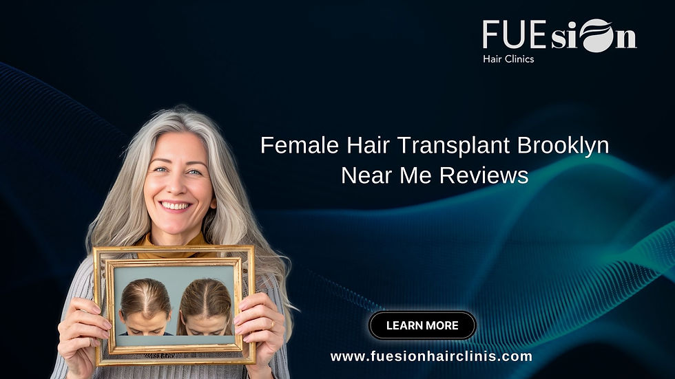FEMALE HAIR TRANSPLANT BROOKLYN NEAR ME REVIEWS: BEST EXPERIENCES AT FUESION HAIR CLINICS