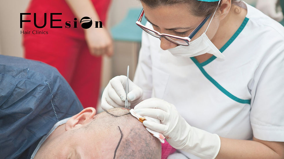 BEST HAIR TRANSPLANT SURGEONS IN THE WORLD: SPOTLIGHT ON FUESION HAIR CLINICS