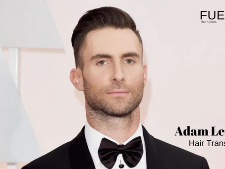 Adam Levine Hair Transplant: Discovering Advanced Hair Restoration at FUEsion Hair Clinics