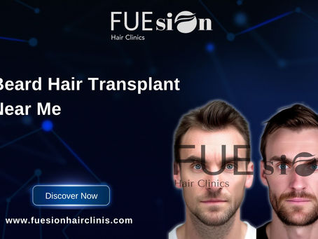 Beard Hair Transplant Near Me – Achieve the Perfect Beard with FUEsion Hair Clinics