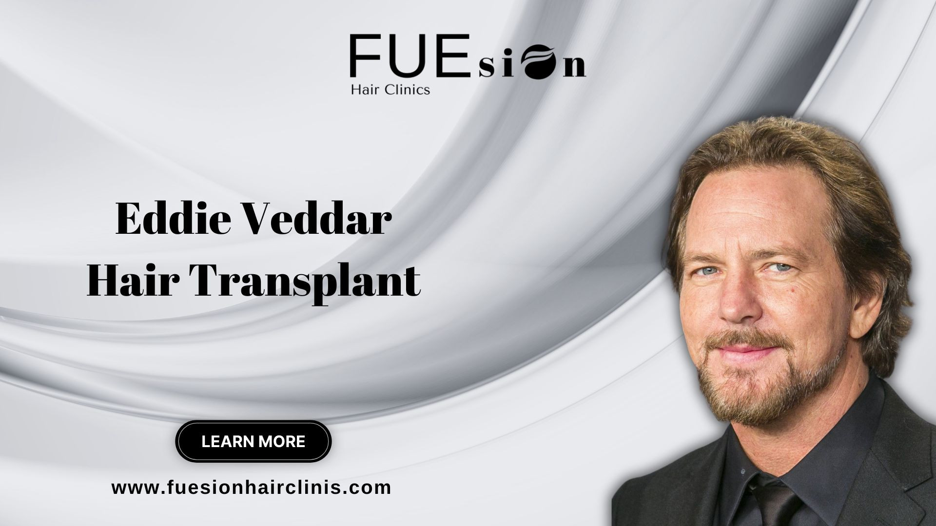 Eddie Vedder Hair Transplant Explore FUEsion Hair Clinics