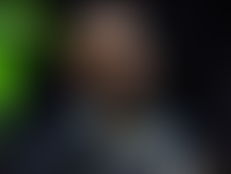 Lebron Before and After Hair Transplant: Transformations at FUEsion Hair Clinics