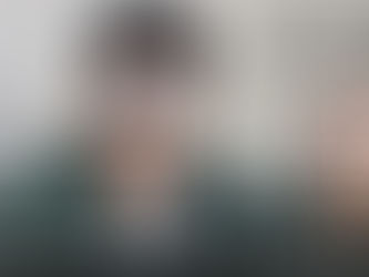 FUE Hair Transplant Westchester County NY: Why Choose FUEsion Hair Clinics for Advanced Hair Restoration