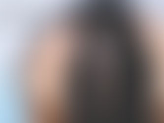 Alternatives to Hair Transplant: FUEsion Hair Clinics The Ultimate Solution
