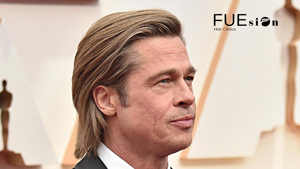 Brad Pitt Hair Transplant Rumors: The Truth About Celebrity Hair Restoration and Why FUEsion Hair Clinics Leads the Way