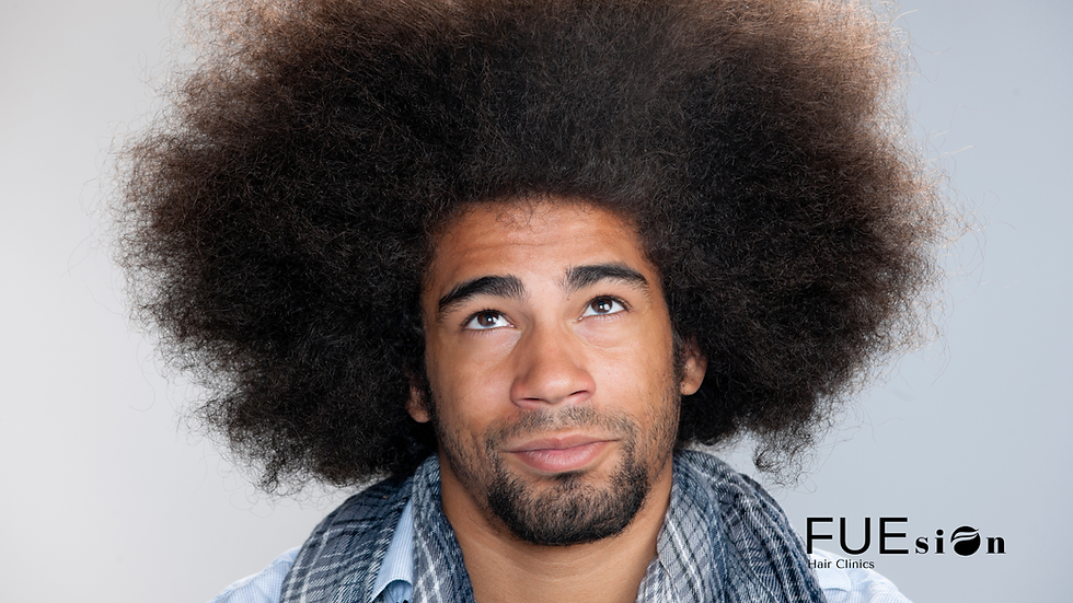 Afro Hair Transplant Before and After: The FUEsion Hair Clinics Transformation