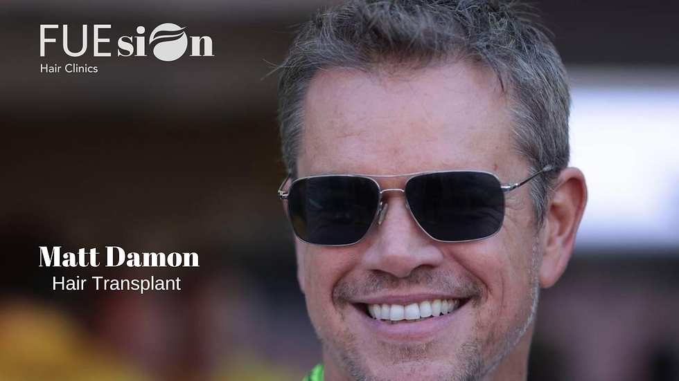 MATT DAMON HAIR TRANSPLANT: TRANSFORM YOUR LOOK WITH FUESION HAIR CLINICS
