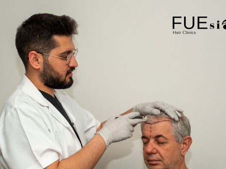 How to Become a Hair Transplant Surgeon: Insights from FUEsion Hair Clinics