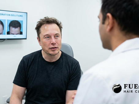 Elon Musk Before His Hair Transplant: Modern Hair Restoration at FUEsion Hair Clinics