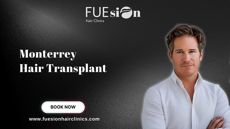 MONTERREY HAIR TRANSPLANT: FUESION HAIR CLINICS SETTING NEW STANDARDS