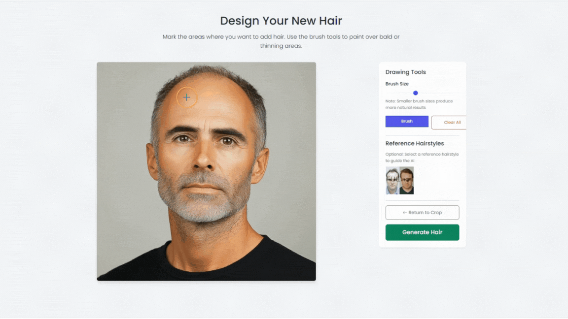 HAIR TRANSPLANT SIMULATOR: TRANSFORMING CONSULTATIONS WITH AI-POWERED VISUALIZATION