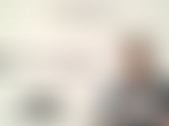 FUE Hair Transplants NY: Transform Your Look with FUEsion Hair Clinics