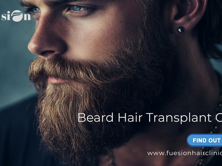Beard Hair Transplant Cost: Why FUEsion Hair Clinics Leads the Future of Facial Hair Restoration