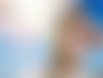 How Long to Avoid Sun After Hair Transplant: Expert Guidance from FUEsion Hair Clinics