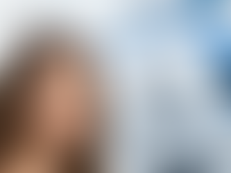 Hair Transplant Cost Woman: Affordable & Advanced Solutions at FUEsion Hair Clinics