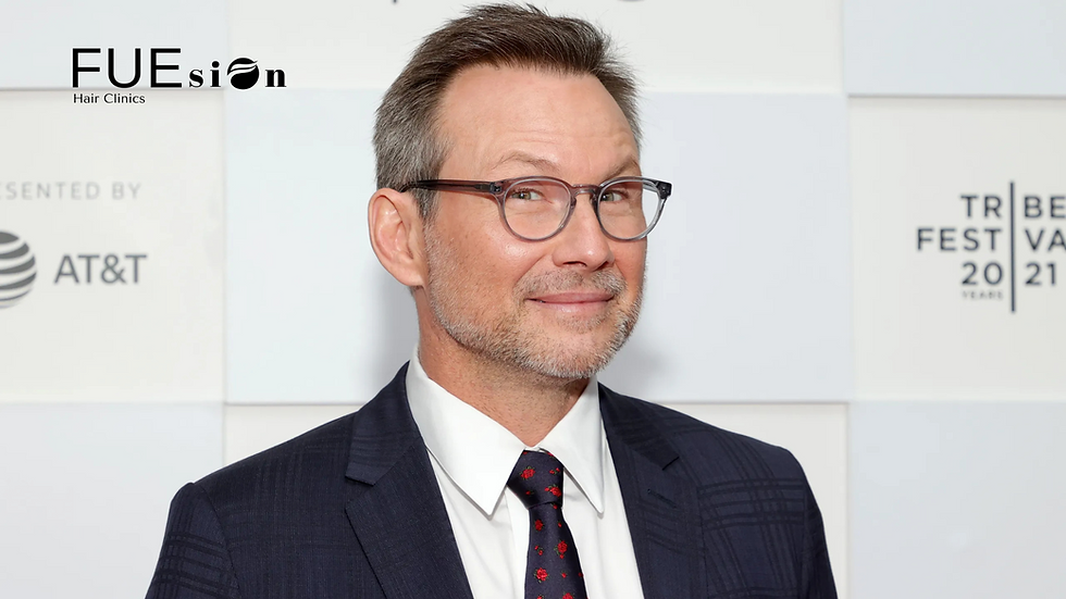 CHRISTIAN SLATER HAIR TRANSPLANT: WHY FUESION HAIR CLINICS SETS THE STANDARD