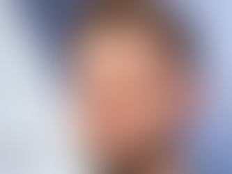 Justin Timberlake Hair Transplant: FUEsion Hair Clinics Set the Gold Standard in Hair Restoration