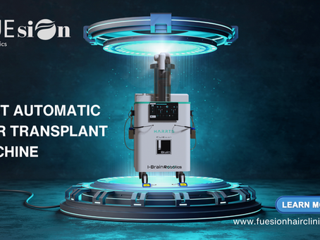 Best Automatic Hair Transplant Machine: Why FUEsion Hair Clinics Lead the Future of Hair Restoration