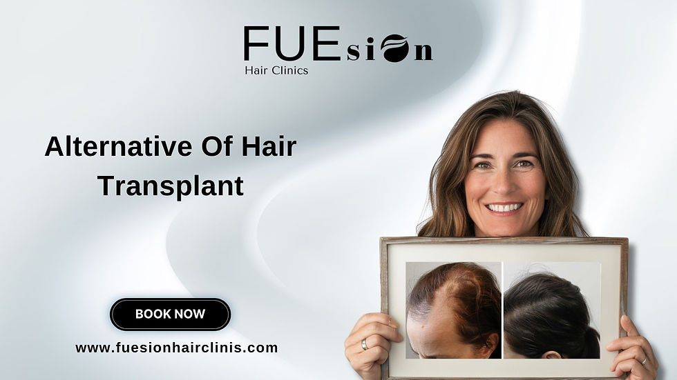 ALTERNATIVES OF HAIR TRANSPLANT: EXPLORING FUESION HAIR CLINICS' NON-SURGICAL SOLUTIONS