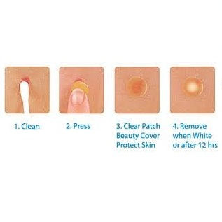 Thumbnail: 香港3M NEXCARE 超薄痘痘隐形贴 36片入 3M NEXCARE Thin Acne Dressing Sticker 36pcs