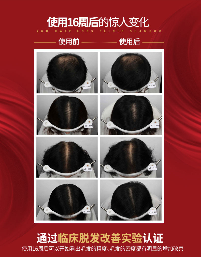 縮圖：韩国RGIII SOMANGR所望 红参防脱生发洗发水露 520ml RGIII SOMANG Hair Loss Clinic Shampoo 520ml