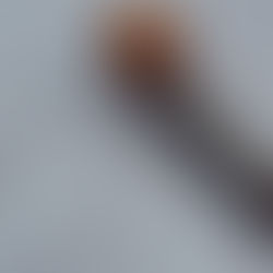 Is Your Immune System Failing You? Understanding Blood Test Ranges, Functional Markers & Immune Imbalance