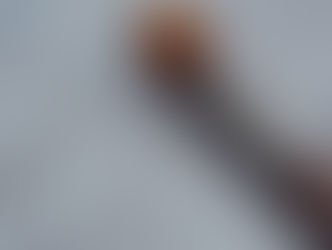 Is Your Immune System Failing You? Understanding Blood Test Ranges, Functional Markers & Immune Imbalance