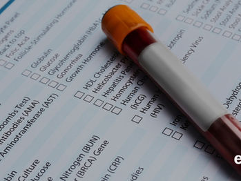 Is Your Immune System Failing You? Understanding Blood Test Ranges, Functional Markers & Immune Imbalance