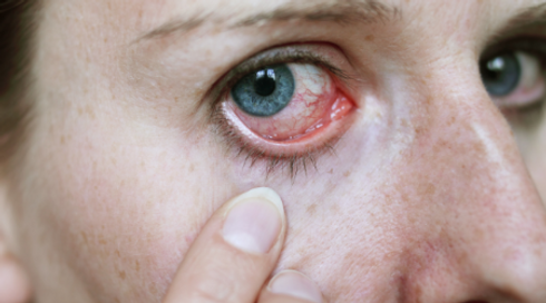 Eye Emergency Services - Bonney Lake, WA