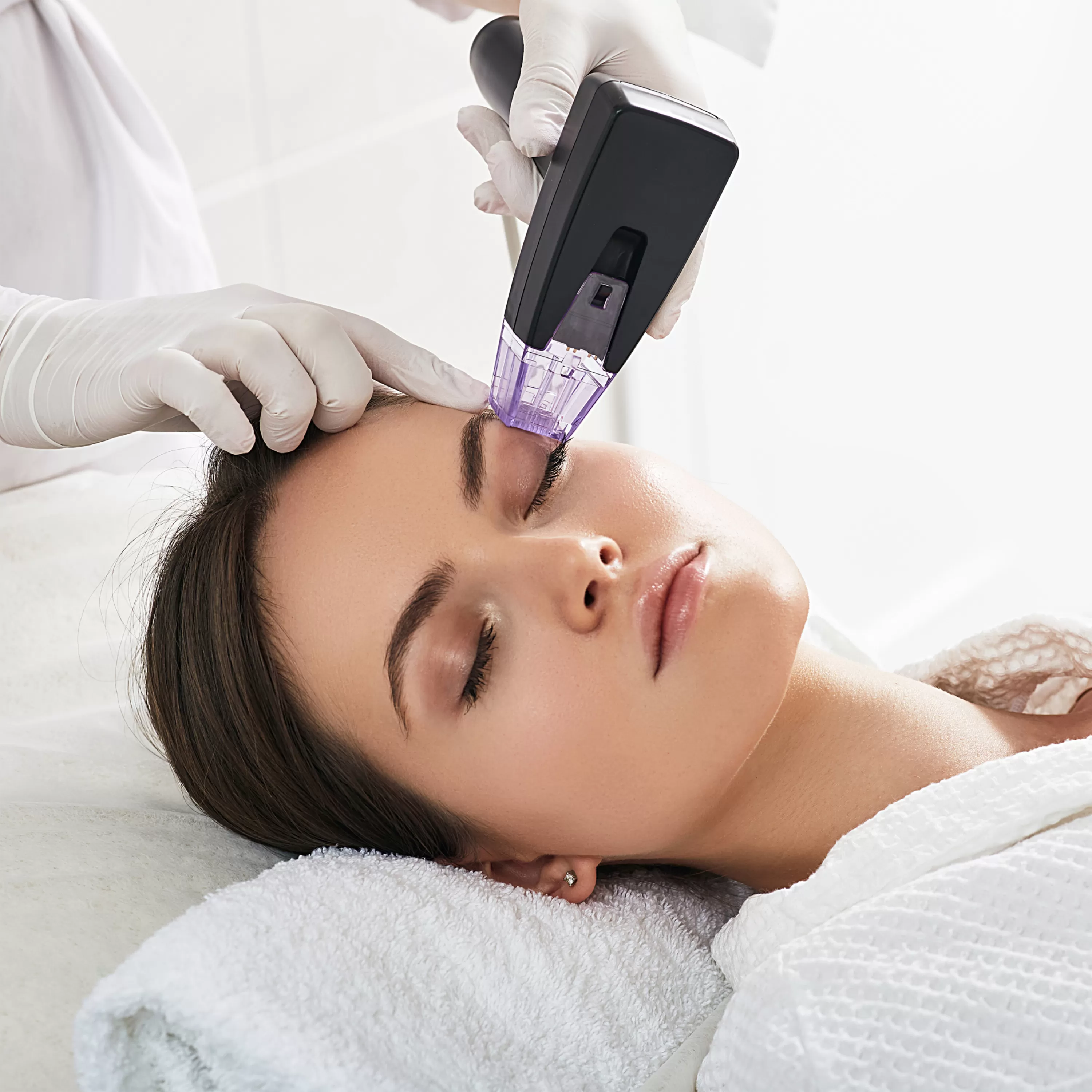 Morpheus 8 Microneedling .webp