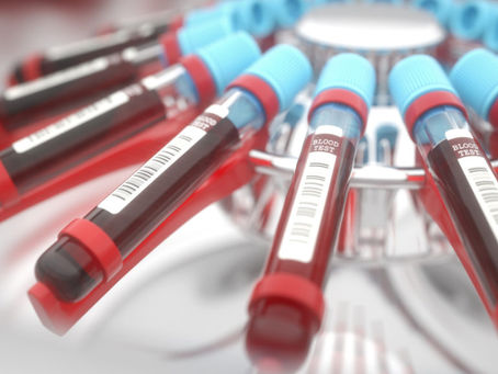 Ischemia Care Company Update
