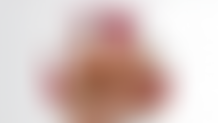 ¿No recuerdas si te vacunaste contra el sarampión? Ante la duda, vacúnate: SSP