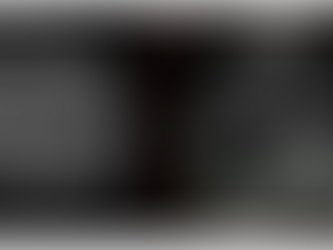 EXTRACCIÓN DE DERIVADA CON LÁSER Y REPARACIÓN DE VENTRÍCULO DERECHO