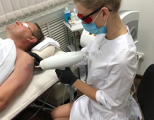 лазерное удаление татуировок в кременчуге