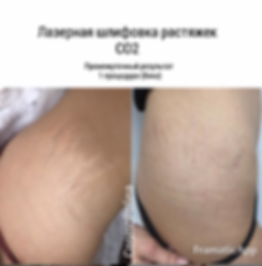Знімок екрана о 22.13.35.png