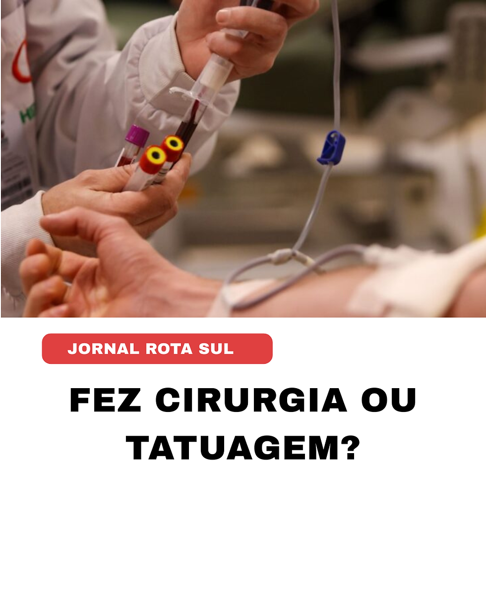 Fez cirurgia ou tatuagem?