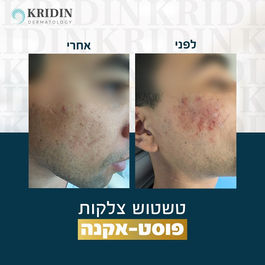 עיצוב פוסטים לרשתות LOGO24