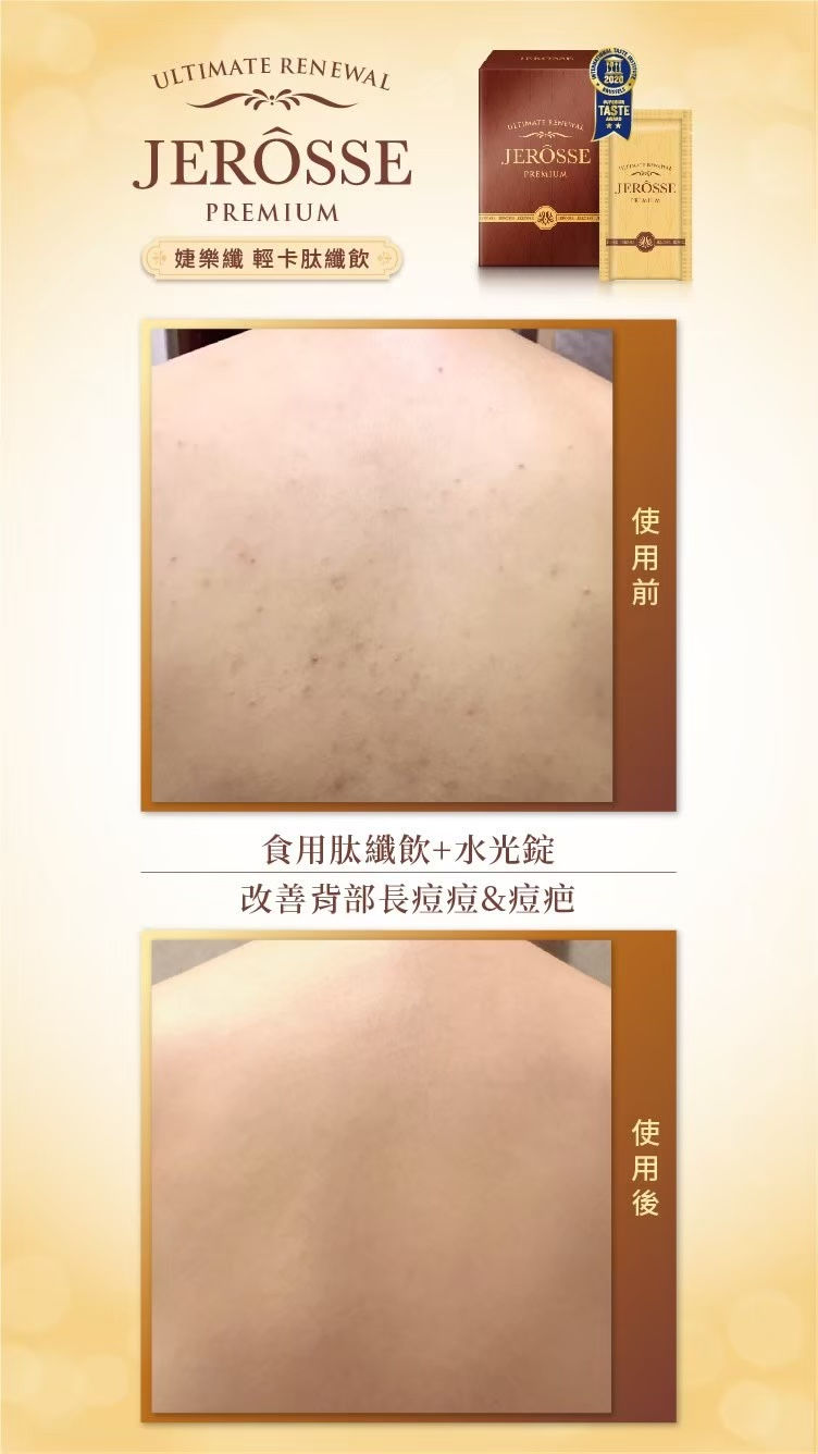 Thumbnail: Testimonials for Ultimate Renewal Chocolate / 肽线饮见证