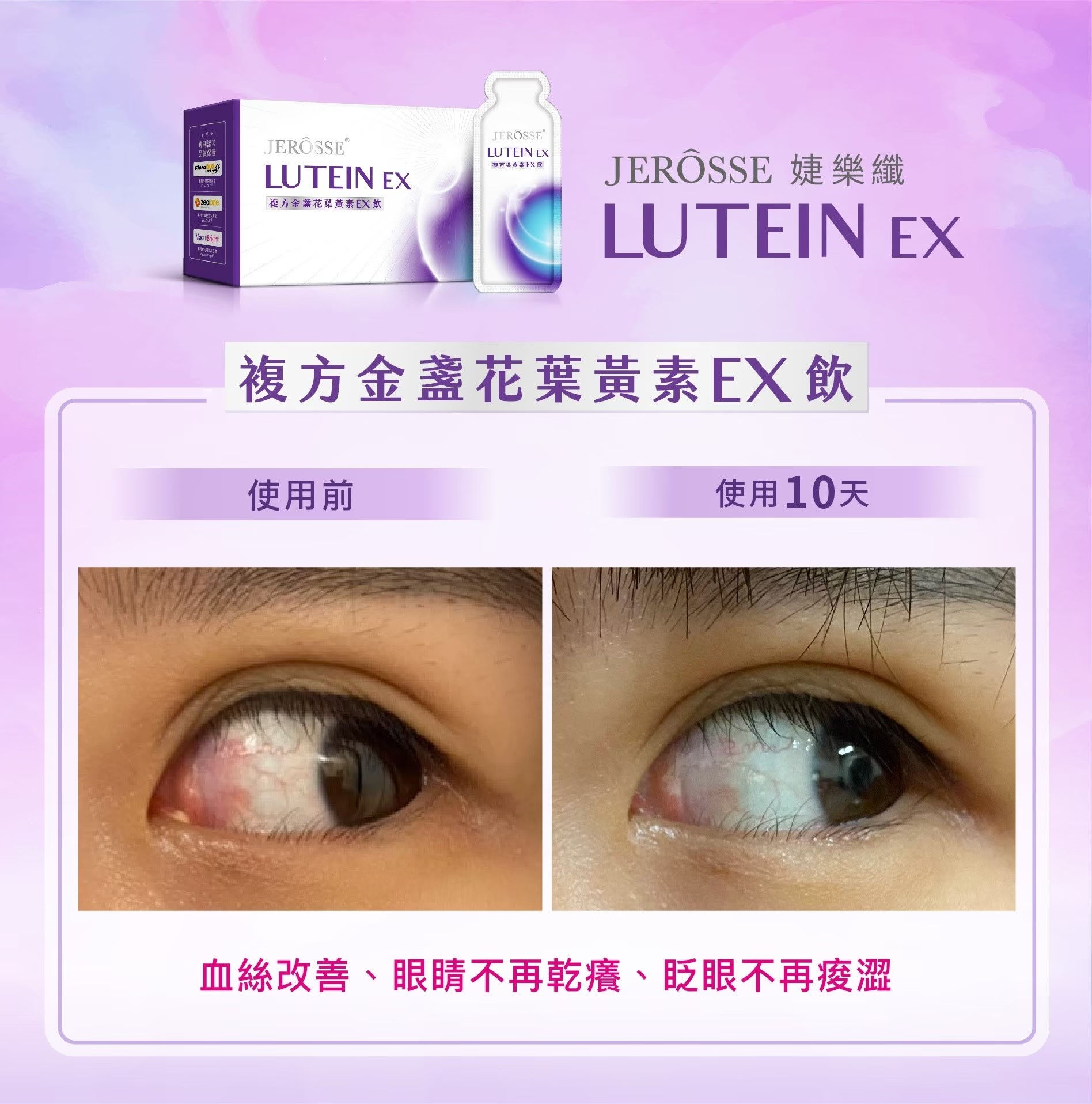 叶黄素的见证