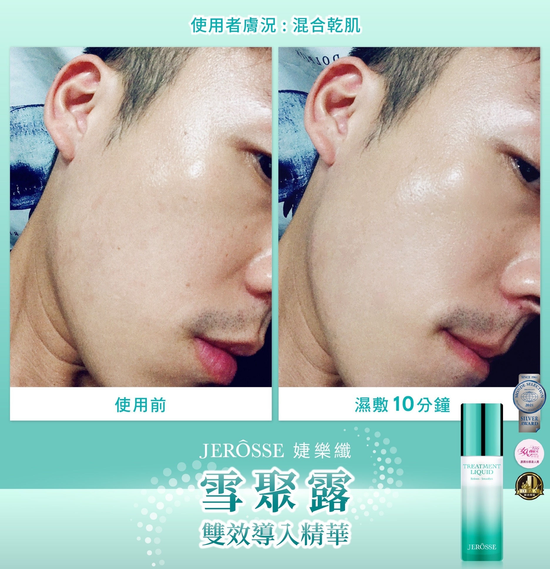 Reviews by Skin Doctors & Testimonials for Treatment Liquid / 雪聚露见证