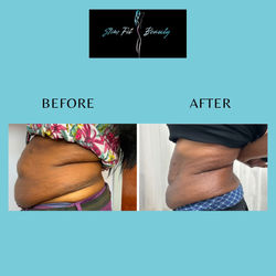 Before and after template - 4