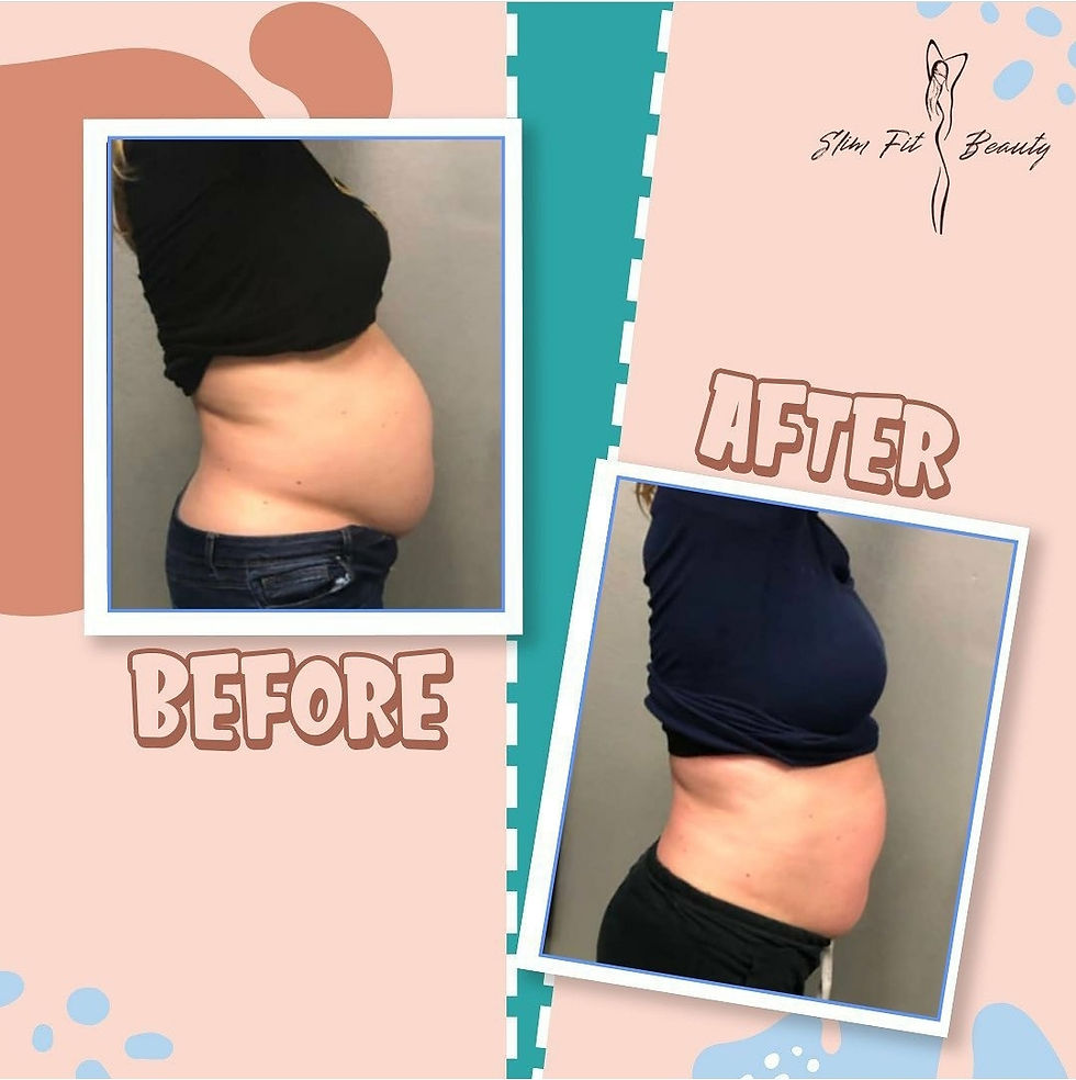 Home Slim Fit Beauty Med Spa