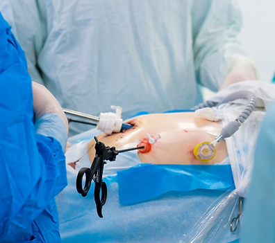 Minimally Invasive and Laparoscopic Cancer Surgery