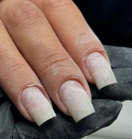 Kusadasi nail cleaning and removal .jpg