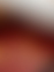 What Does ‘No Win No Fee’ mean?