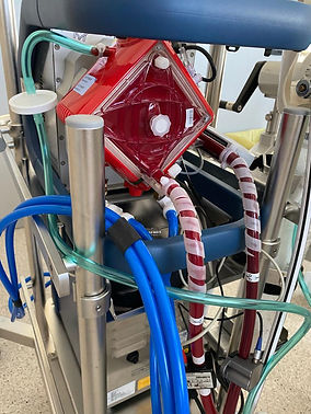 Oltre il Covid: effettuata una donazione di organi a cuore fermo grazie all’Ecmo