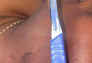 dermaplane.jpeg