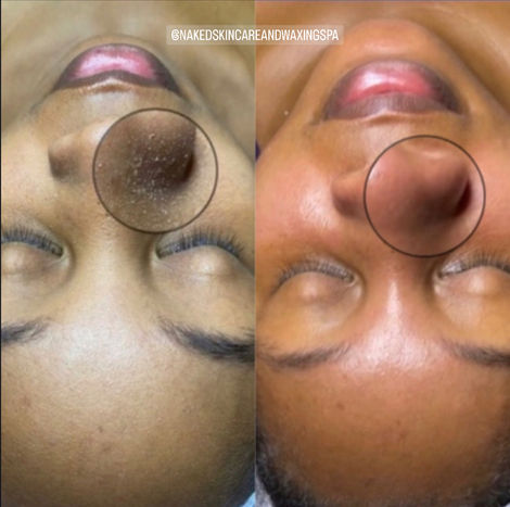 Hydrating Vita-C Enzyme Facial